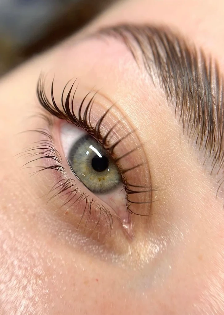 Skin needling microneedling treatment Bentleigh East